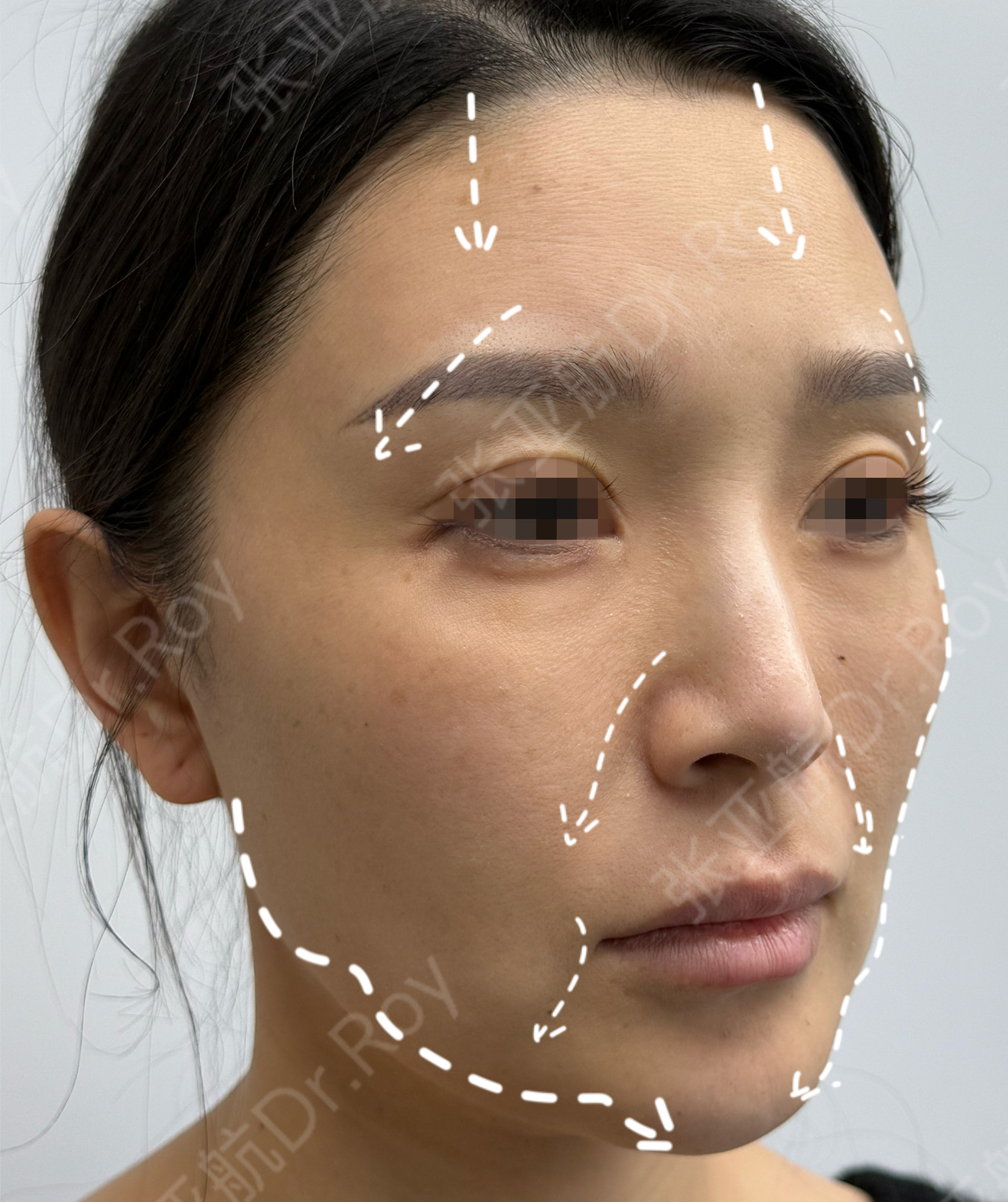 JuveFace® 授权案例 01 分析