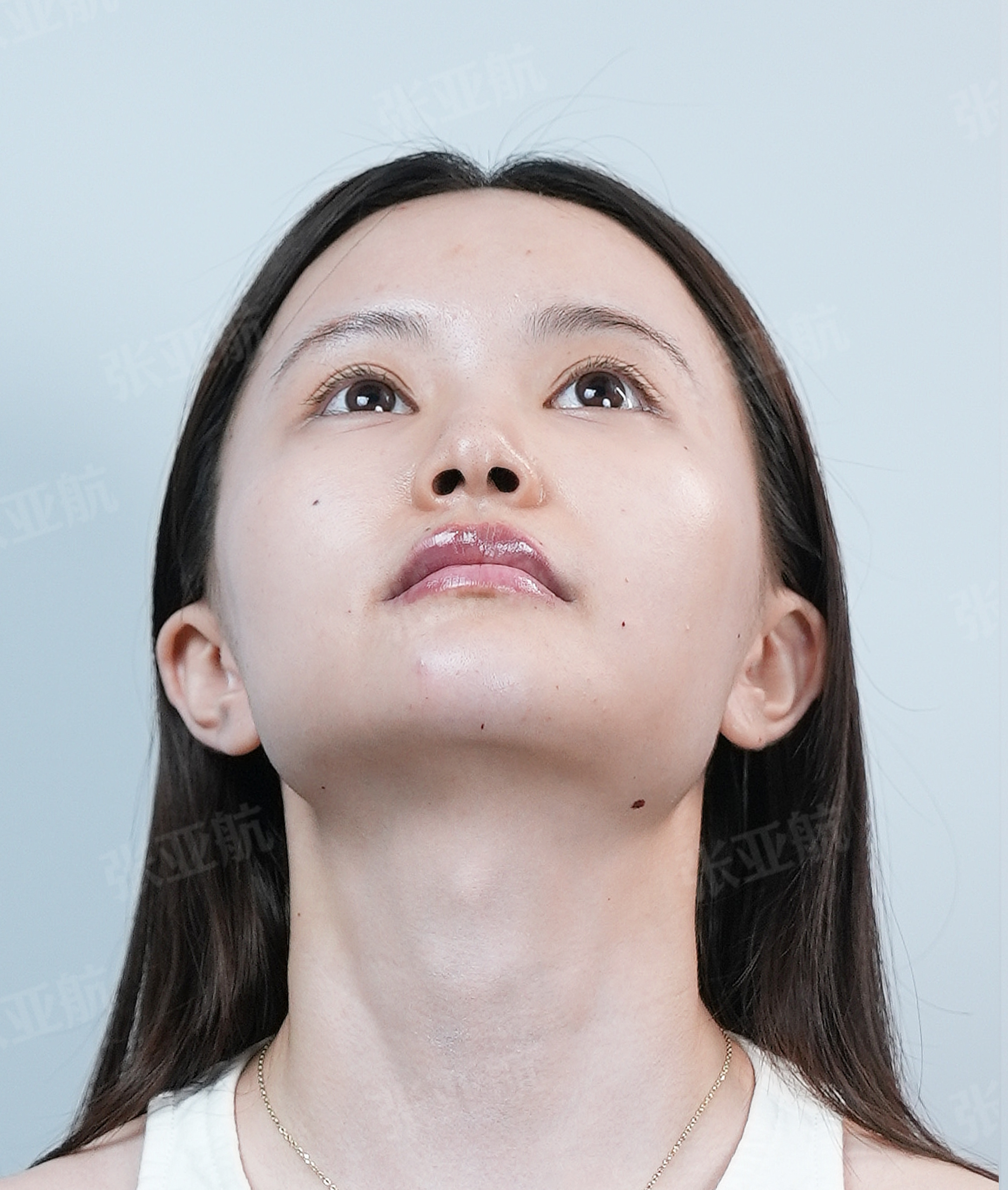 颈部与下颌线示例